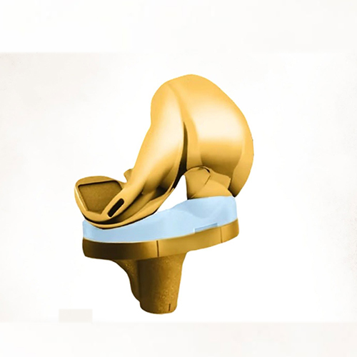 Golden Knee Implants in Vijayawada