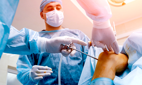 Arthroscopy in Vijayawada