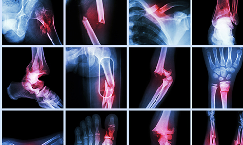 Complex trauma treatment in vijayawada