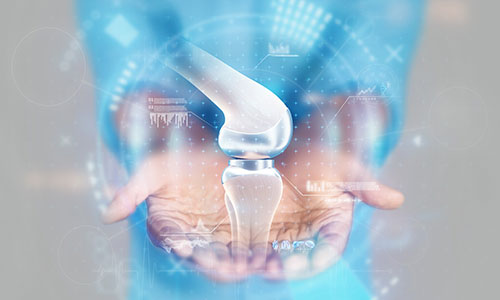 Joint Preservation in Vijayawada